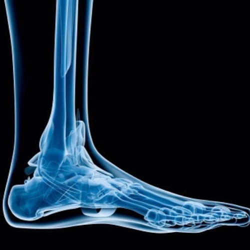 The resource and feed for tendinopathy information including treatment, exercise and rehabilitation tips.