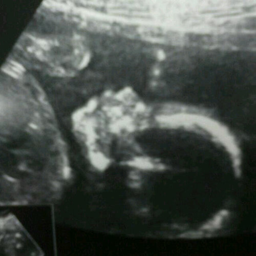 Futuro hijo de Sam y de Sean