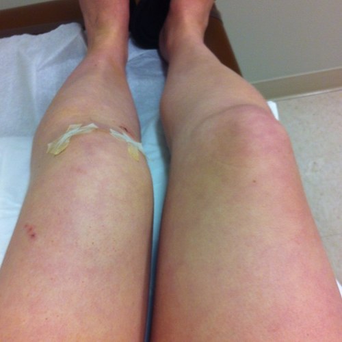 aclsurgeryprobs's profile picture. 