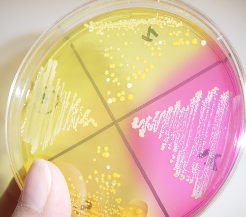 virology and bacteriology lab
