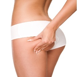 Cellulite_Cures's profile picture. #Cellulite Treatment Reviews. Read Cellulite Cream and Treatment Reviews. http://t.co/Qht7jwbp8Q