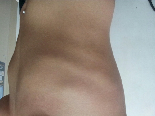 18/SH/EDNOS/Insomnia/Social Anxiety/H:5'3/CW:FAT FUCKING MESS/GW: 115/UGW: bones  INSTAGRAM: lostinednos