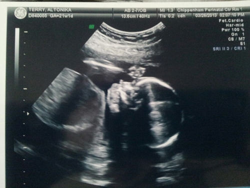 xHis_LadieeKees's profile picture. Juz Me , My Mak`iyla , and Markee. My Two Dats All I Need and Dey Makes Me Soo Happy :))