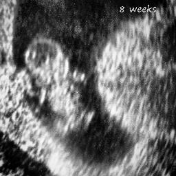RobAndHaley Profile