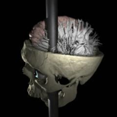 markwheeler88's profile picture. Former media relations rep at UCLA covering neurosciences. Often cranky. (Image courtesy of Jack Van Horn)