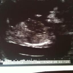 elleboo118's profile picture. yo ma peeps, ma broder from a noder moder, ma sister from a noder mister xxx