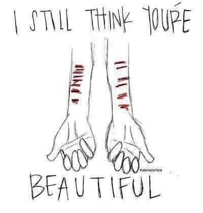 I've dealt with self harm i will always care/helping those at war with themselves fight and be strong/ so fallow i follow back (: