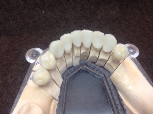 Dental Laboratory making NHS, independent and private restorations. Same day denture repairs. Call 01302 343815
