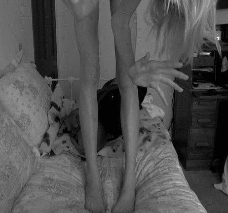 I'm 20 and happily married. But I can feel ana creeping back into my mind. I need to be thin thin thin