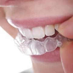 trabajamos con coronas provicionales, protesis acrilicas combinadas con o sin oro, ferulas dentales para todo tipo de diagnostico, ortopedia y ortodoncia dental