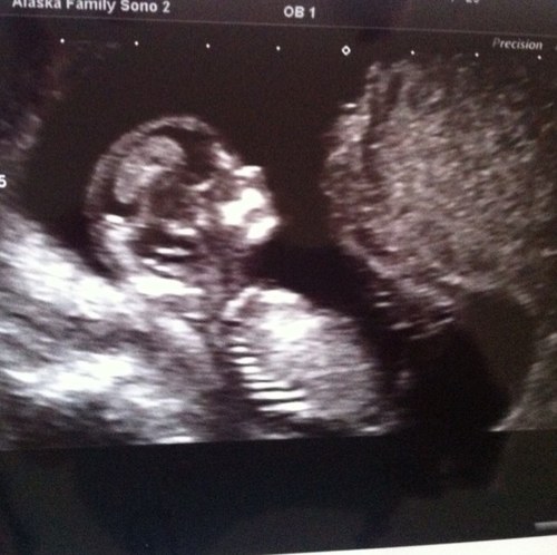 alexkalove's profile picture. 