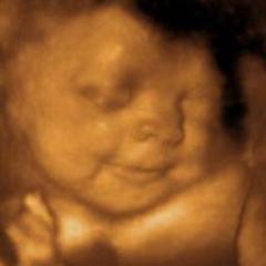 schedule your 3D 4D ultrasounds today and like my                   facebook page @signetultrasound3d4d