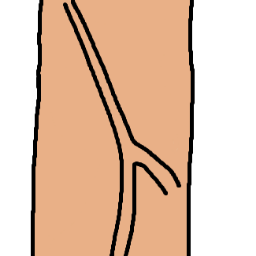 De penis fabriek, volg komediek