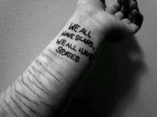 17. Una vez me dijeron, que quien piensa en el suicido, es porque quiere matar el dolor, no la vida.