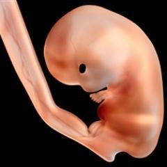 Representamos todos los bebes no nacidos, los que tuvieron la gracia de nacer como tú y los bebes que están en riesgo de ser abortados. https://t.co/TGVmfs49XJ