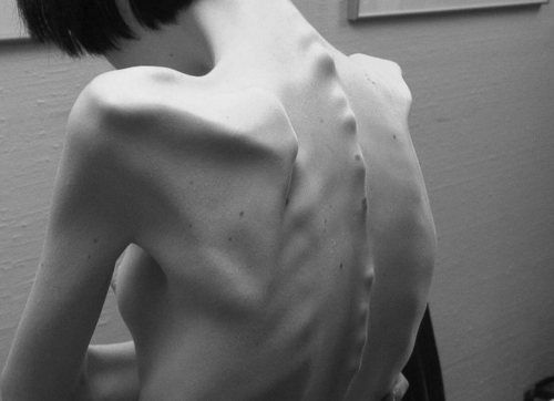 Starving for perfection