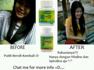 kulitcantikmu's profile picture. Ga jaman banget hari gini masih kalah cantik sama yang lain ☺ mention skr / invite pin nya di pin:328a72cc:*