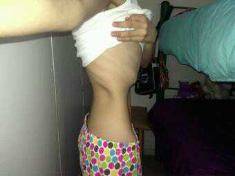 People say you fat
not knowing how you feel
Si no te burlas de la vida, la vida se burlara de ti .
 ♥ Cutting ♥
