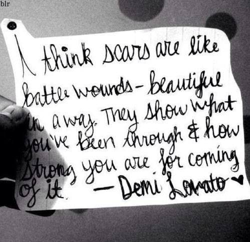 Talkimhere's profile picture. I dont care who you are, if you want someone to talk to im here okay. Stay strong beautiful babes xx everyone is beautiful xxx