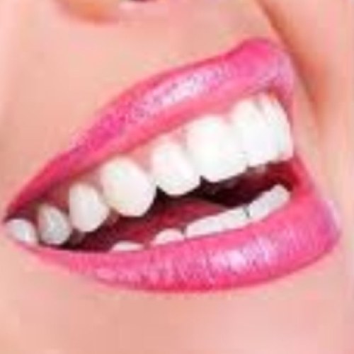 Puredental, 3 boutique General & Cosmetic Dental Clinics in Liverpool & Southport - ZOOM whitening, smile makeovers, Invisalign braces, FASTbraces, implants ...