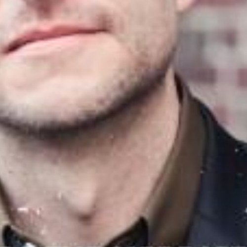 adomsapple's profile picture. I hang out on Chris's neck.