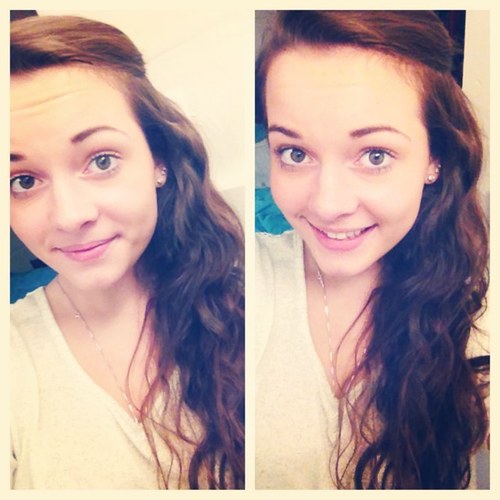 Everybody's youth is a dream, a form of chemical madness - F. Scott Fitzgerald