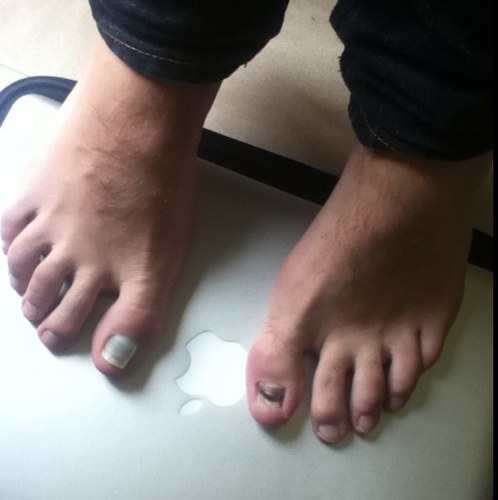 Pied Moche Piedmoche Twitter