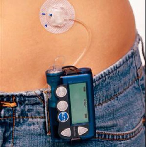 T1D_probs's profile picture. Type 1 diabetes problems. From the perspective of a type 1 diabetic.