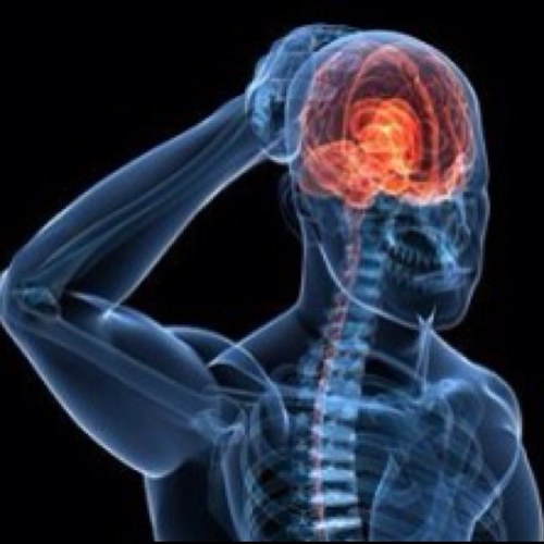 I have 99 problems & can't remember 1. #concussionprobs
