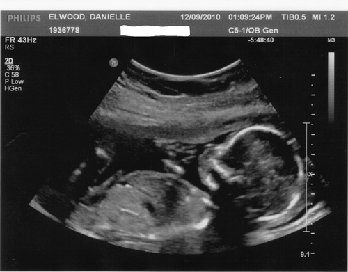 I once had MOTHER and CRAWLSPACE. Then i had neither and was stuck in the LAND of the Neverending Story. That was terrible. AND now im a fetus. Life, y'know!
