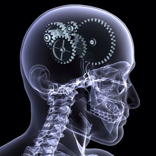 Spot daignosis, reveiw and quiz in Neurology for medical students, interns and doctors. By Dr.Sanosi & Dr.Ayoub ,Assistant Professors of Neurology at KAU