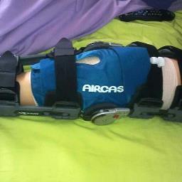 Been through it twice | Living proof that you CAN survive knee surgery