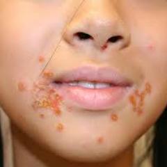 to show increased signs of skin aging and slower recovery from a variety of environmental stressors.