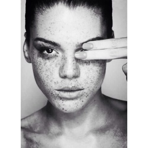 its all about the freckles