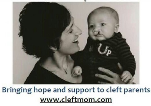 I'm Jaimee, mom to 3 fabulous children. My handsome little boy was born with a cleft lip and palate. Sharing his journey and positive thoughts.
