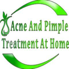acne and pimple treatment at home.we help you how cure your acne and pimples by bringing you the helpful information you needed