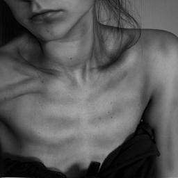 dying to be thin.
