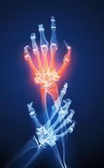 North Jersey Rheumatology Associates M. Guma D.O. S.Mody M.D., N. Gatla M.D., H. Sugar, MS, PA-C 312 Belleville Turnpike Ste 3A North Arlington, NJ 07031