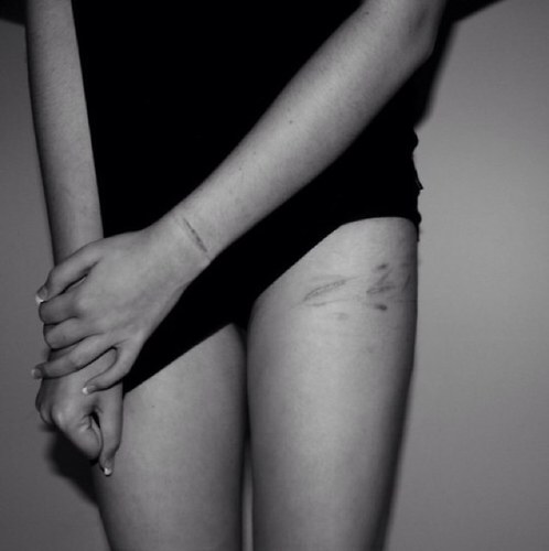 I am struggling to live, i am slowly killing myself. Never good enough. Depression, bipolor, eating disorter, selfharm, sucidal