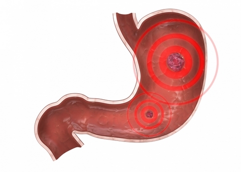 Centro de enfermedades gastrointestinales. Que requieran resolución médica, endoscopica y/o quirúrgica.