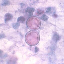 The goal of idimages.org is to present images of interesting and instructive Infectious Disease cases to healthcare professionals for educational purposes.