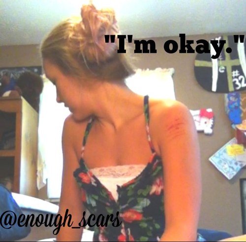 Insta- enough_scars kik- youre_beautiful. no one should feel like suicide is the only way out