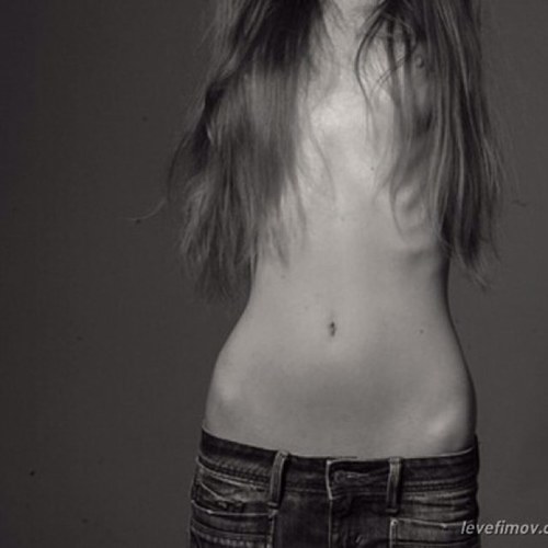 currently going through an eating disorder, have no friends, i cut myself daily and im obese, no exaggeration, im a whale and i never get guys love me, hi there