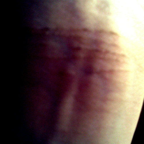 _xdepressed Profile Picture