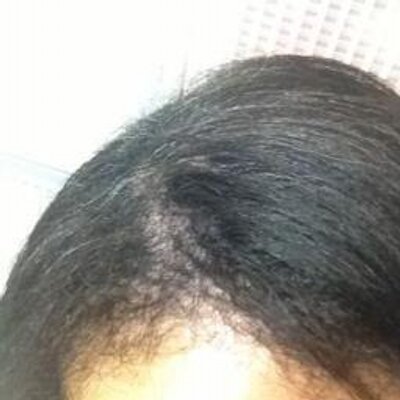 チリ子 Twitter પર 幼い息子に おかあさん かみのけボサボサだから はんぺーんした方がいいよ と言われた事がある はんぺーん パンテーン パンテーン くせ毛 言い間違い チリ子 Twitter પર 幼い息子に おかあさん かみのけボサボサだから はんぺーんした方がいいよ と言われた事がある はんぺーん パンテーン パンテーン くせ毛 言い間違い