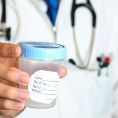 Learn the secrets to passing a urine drug test.