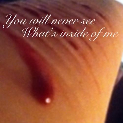 trust me, ive been there. im still there. i want to support you all the way.