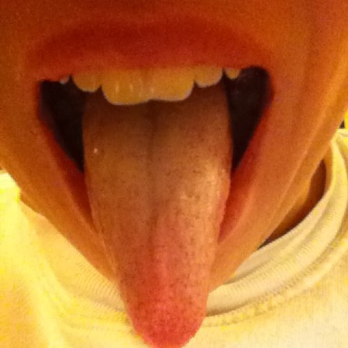 Reddio
