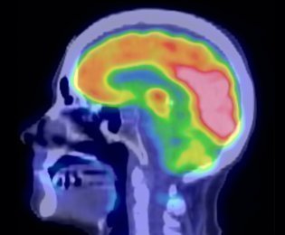 PipeTatan's profile picture. Médico por vocación, sin aspiración a tener grandes adquisiciones. Amante de la lectura, la naturaleza, los idiomas, la música y la cultura.