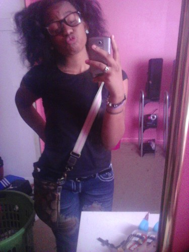FMOI@bracefaceeeeee__